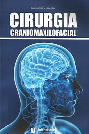 Cirurgia Craniomaxilofacial